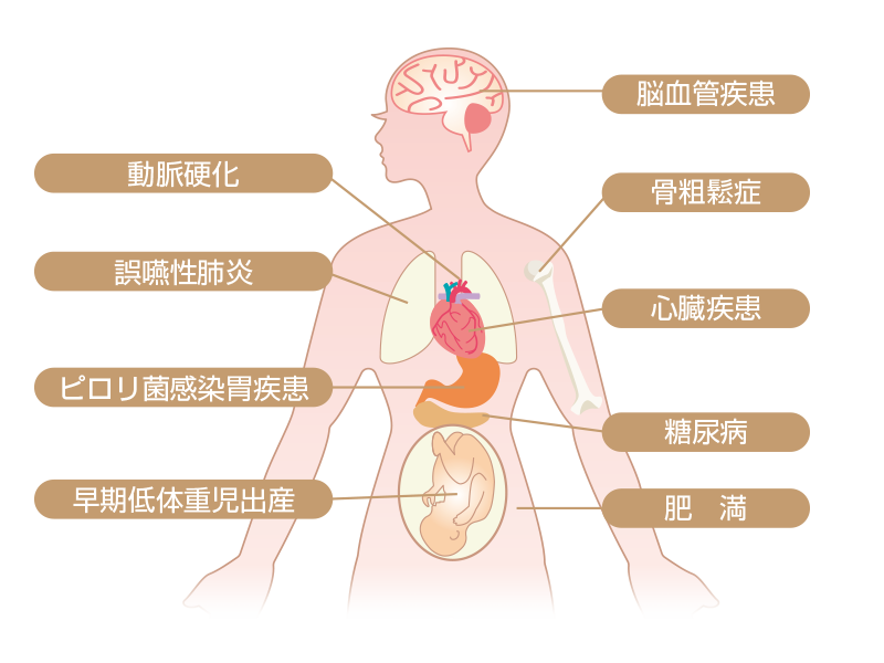歯周病と全身疾患
